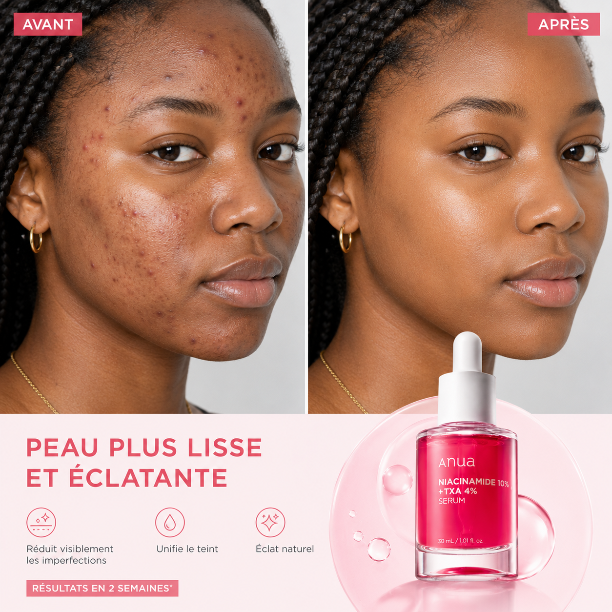 Sérum Éclat Anua – Adieu Taches, Bonjour Teint Parfait 🌸
