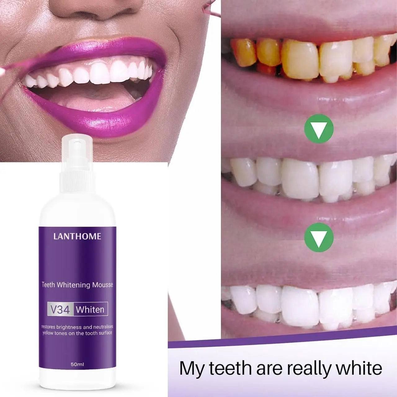 Pâte de Blanchissante Dentaire V34 – Un Sourire Plus Blanc, Plus Confiant !