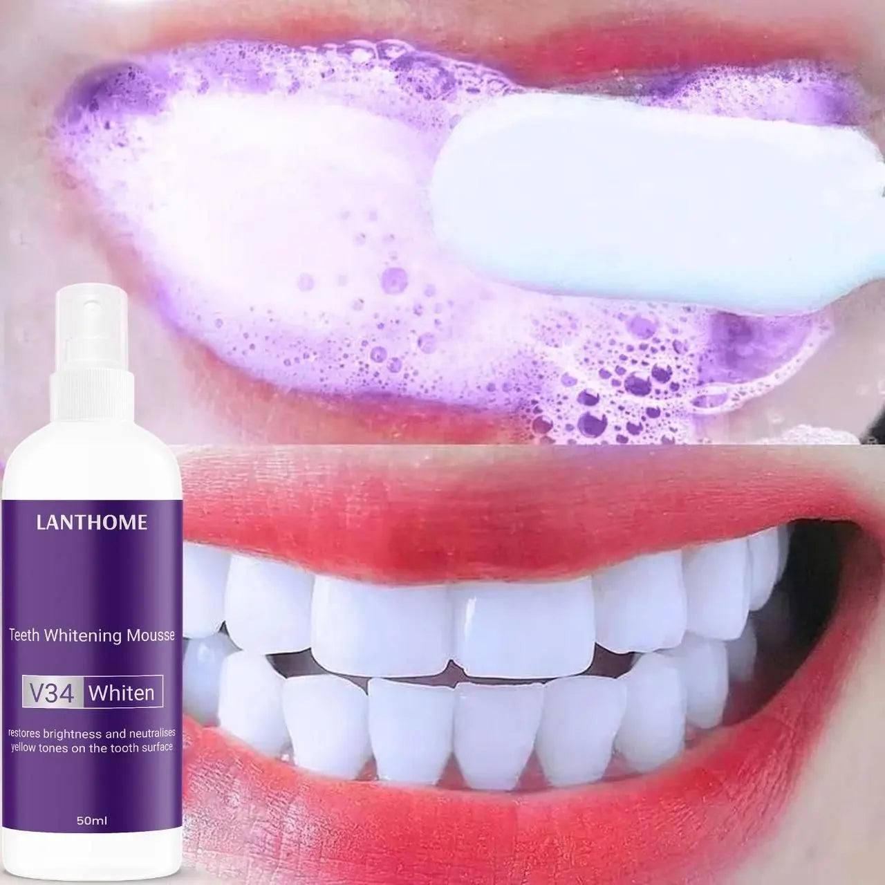 Pâte de Blanchissante Dentaire V34 – Un Sourire Plus Blanc, Plus Confiant !