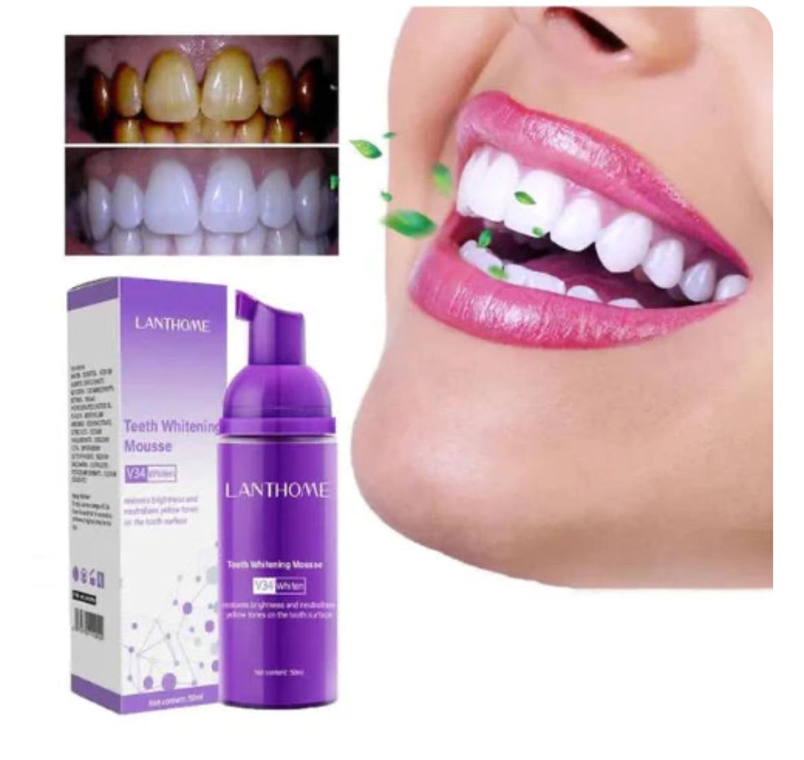 Pâte de Blanchissante Dentaire V34 – Un Sourire Plus Blanc, Plus Confiant !